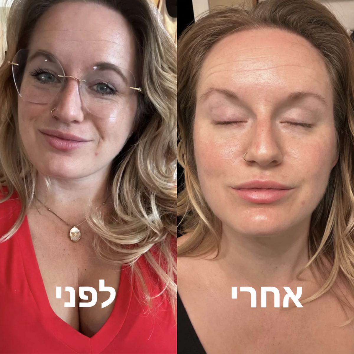 מסכת קולגן למראה עור זוהר 2.0