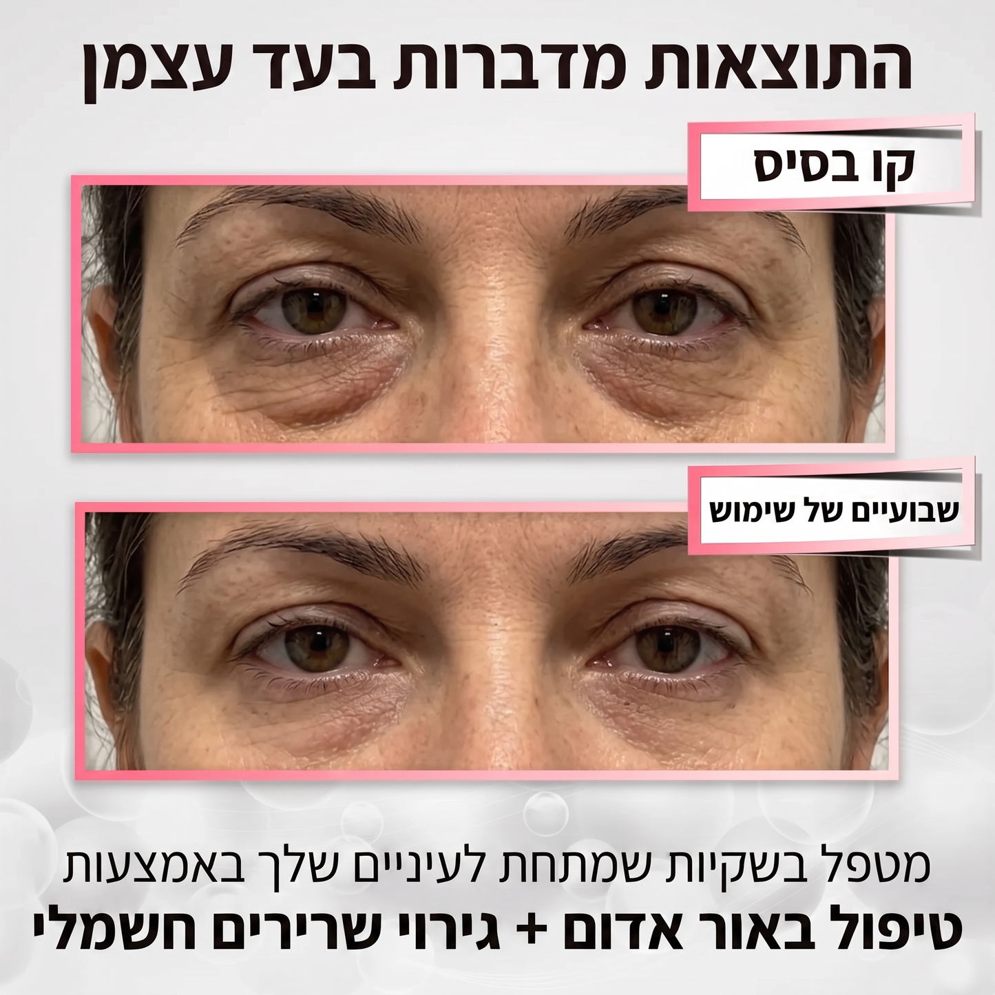 Mivo Lumière™ משקפי 2-ב-1: אור אדום + EMS להפחתת שקיות ונפיחות מתחת לעיניים