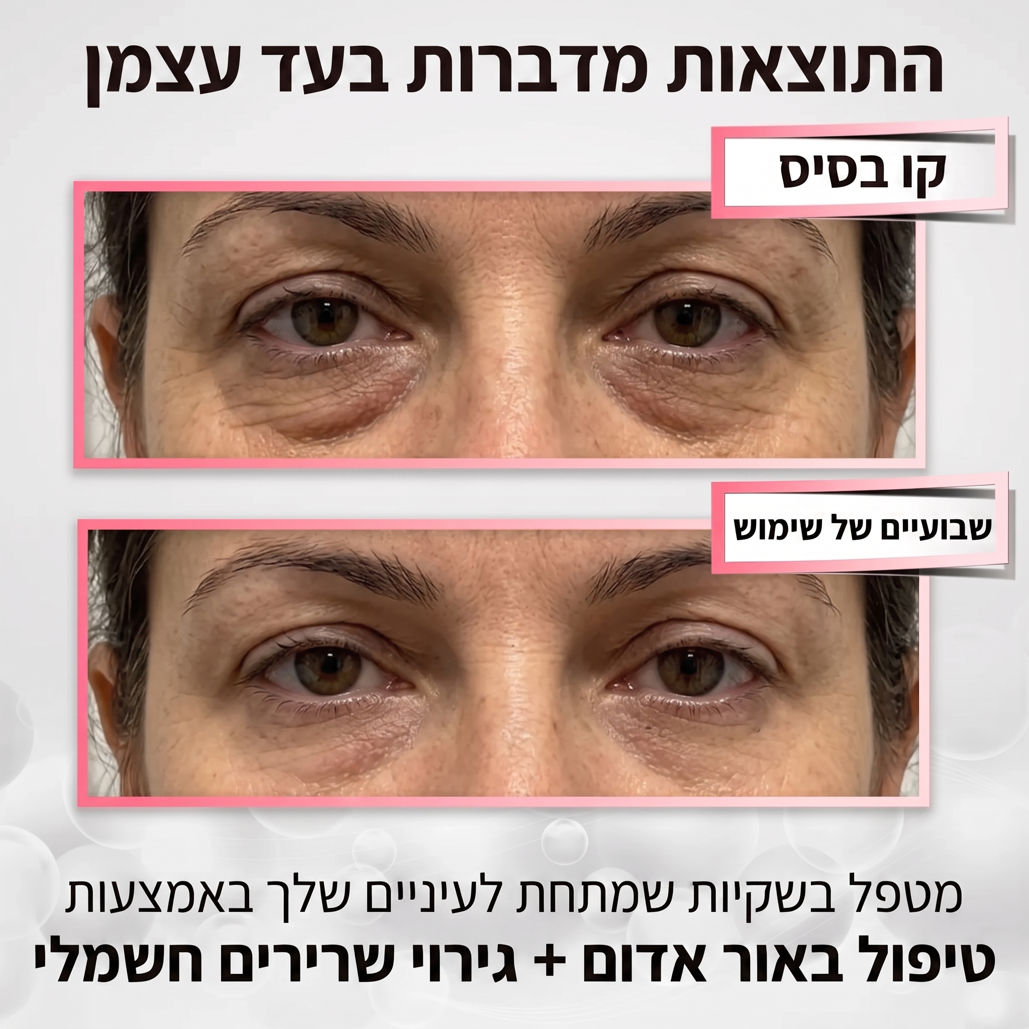 Mivo Lumière™ משקפי 2-ב-1: אור אדום + EMS