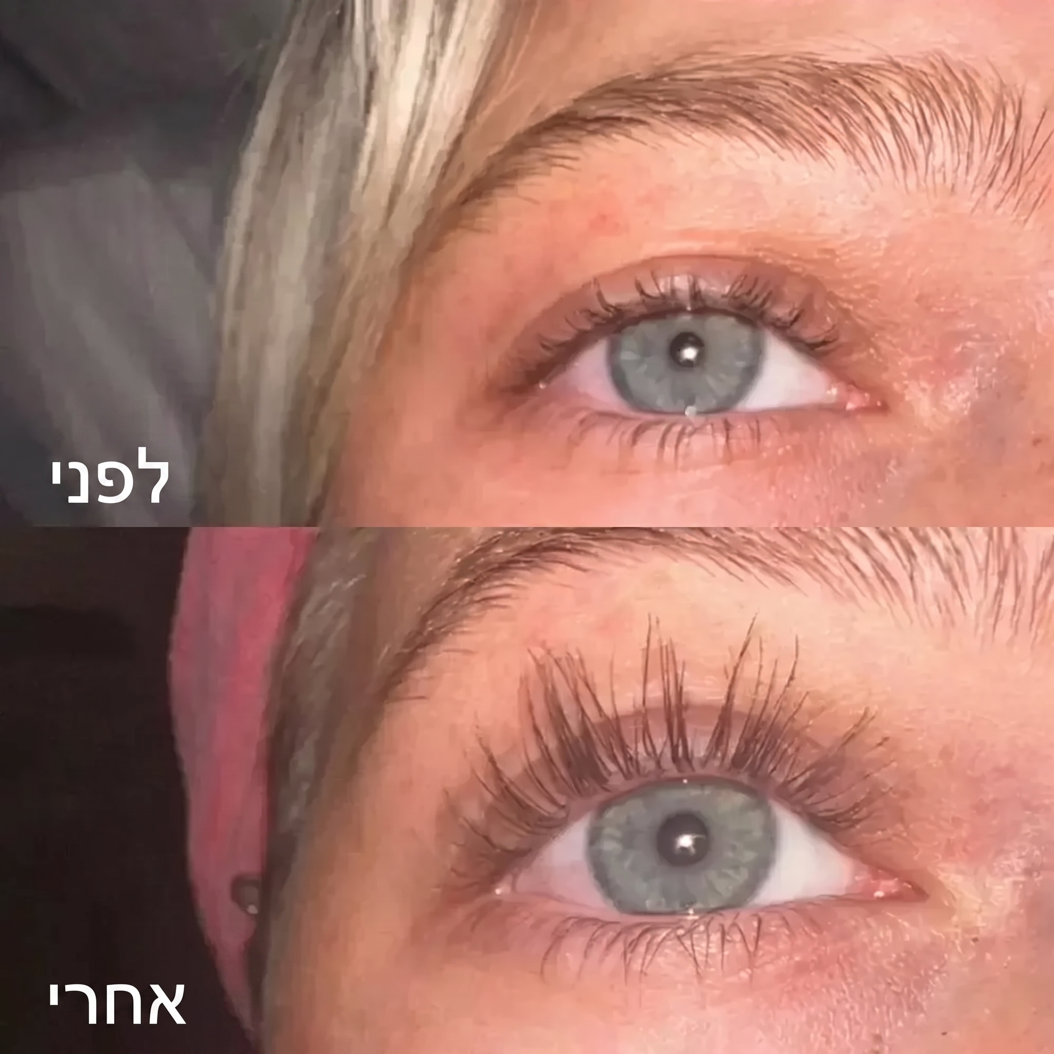 סרום להארכת ריסים