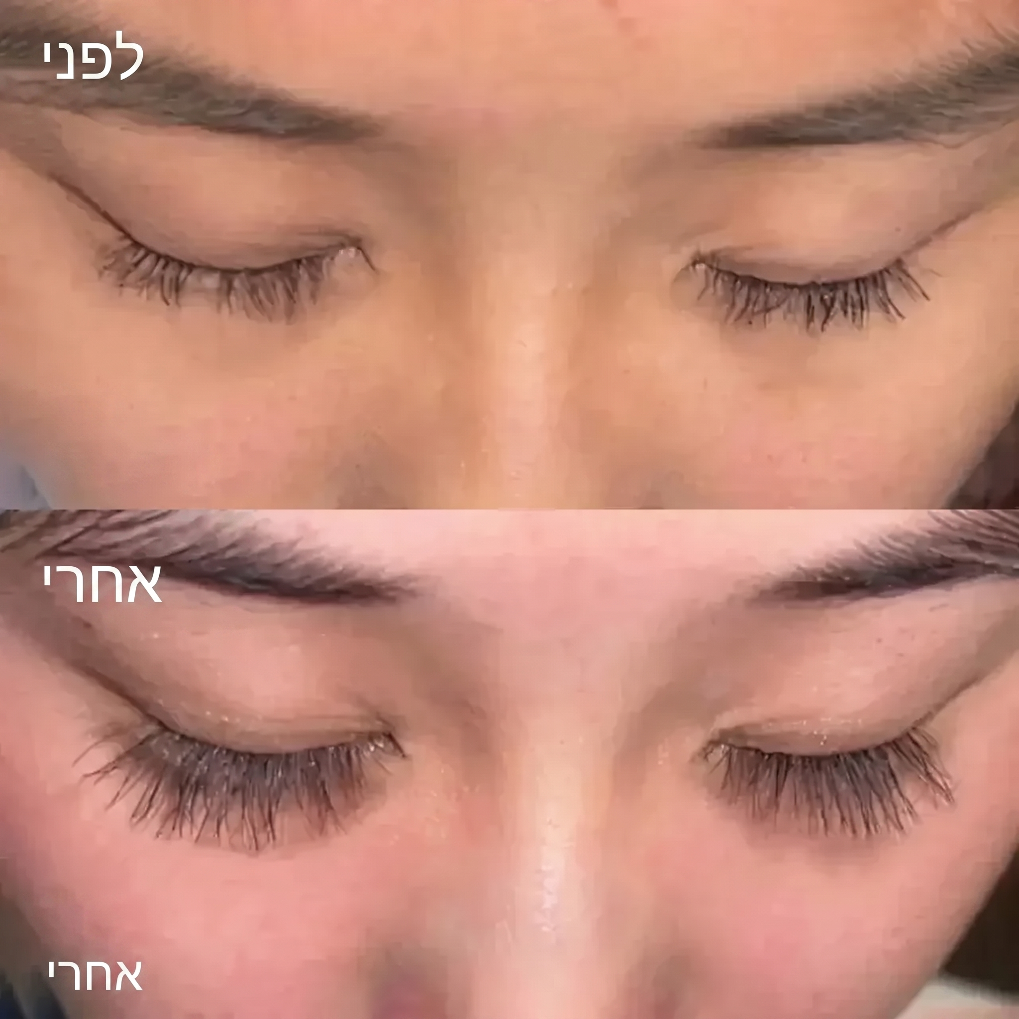 סרום להארכת ריסים